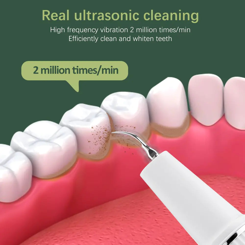 Ultrasonic Tooth Cleaner With Camera